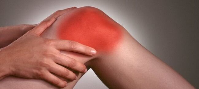 ból kolana z powodu zapalenia stawów