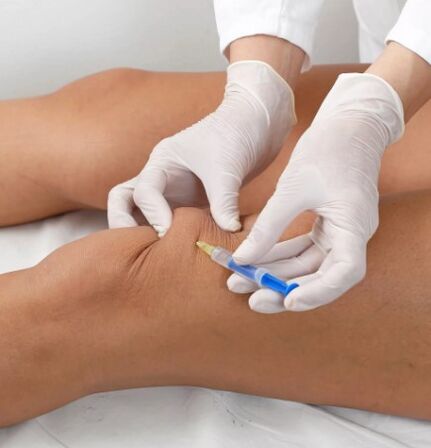 Ozonoterapia