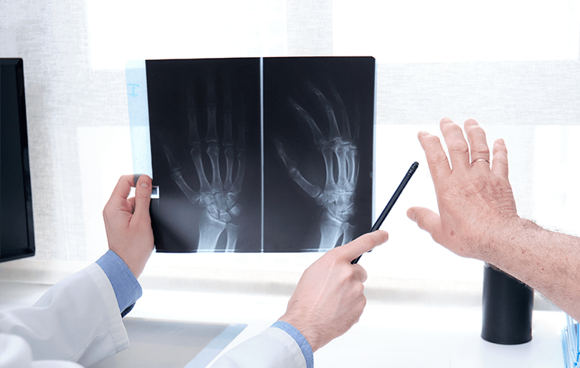 diagnostyka artrozy stawów